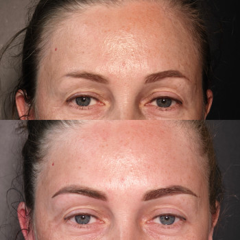 Корекція брів після іншого майстра.