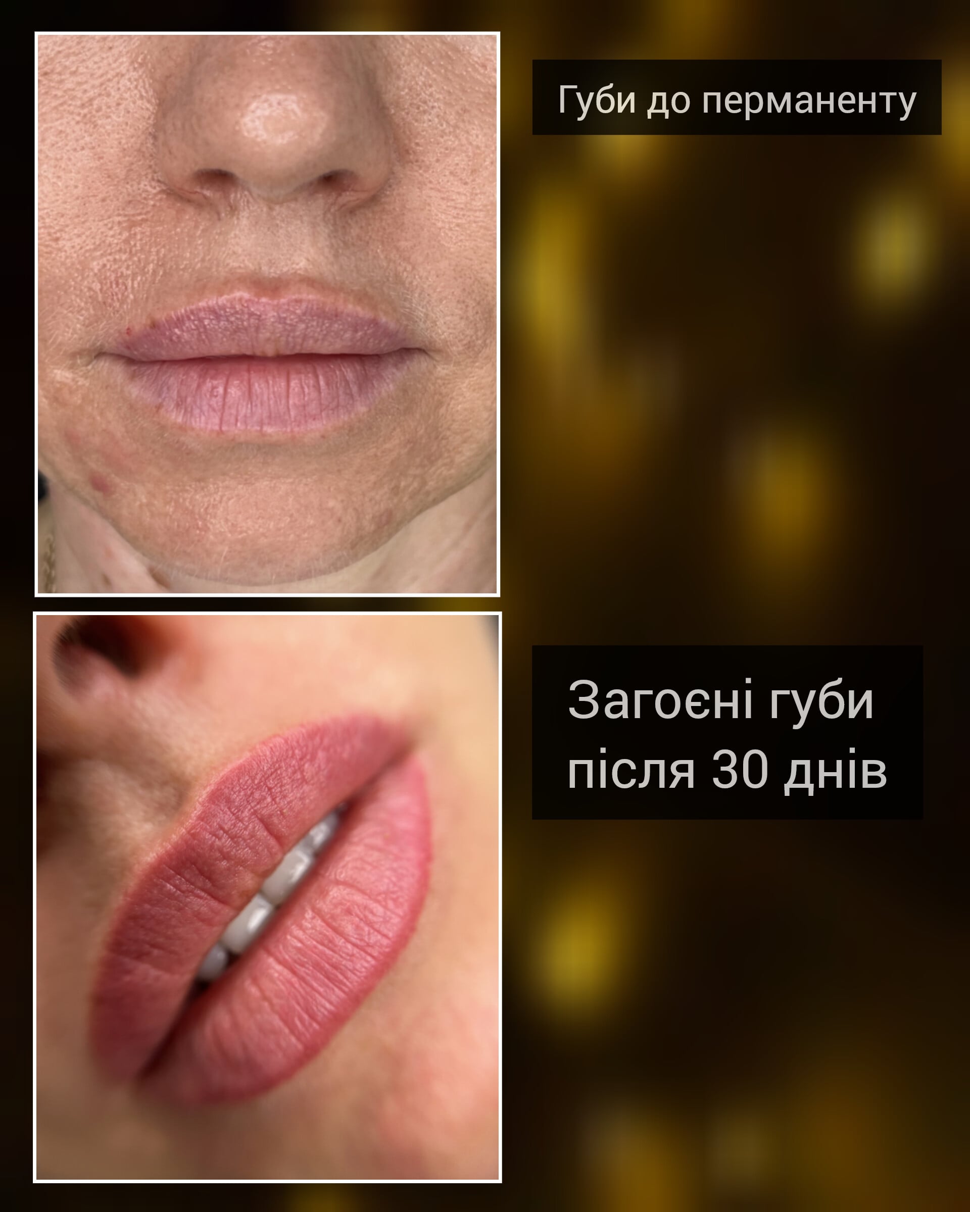 Губи до / загоєні губи, фото - Майстер татуажу Ольга Кравченко