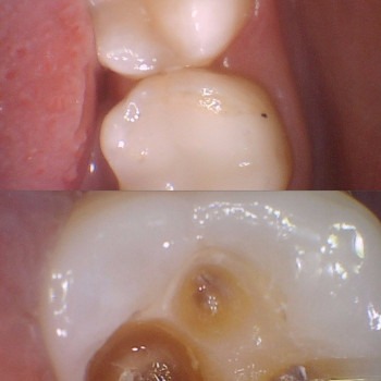 Фото с портфолио Premier Dent