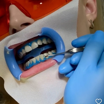 Фото с портфолио Premier Dent