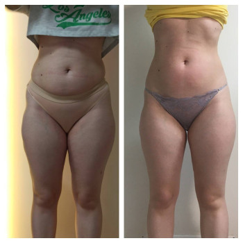 Фото с портфолио Ендосфера