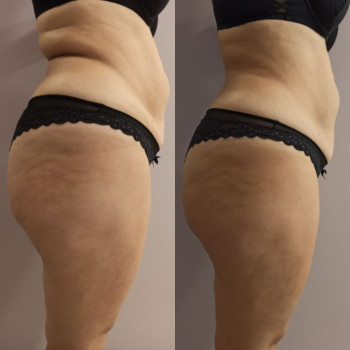 Фото с портфолио Ендосфера