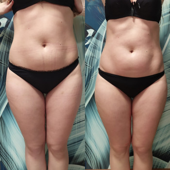 Фото с портфолио Ендосфера