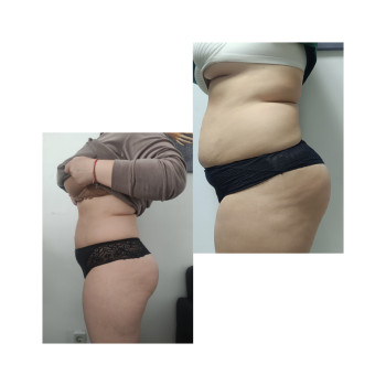 Фото с портфолио Катерина Дроб'язко