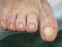 Педикюр +консультація=900 Подолог  Київ