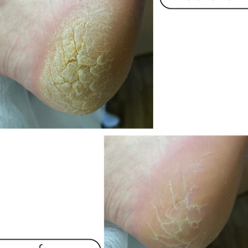 Фото с портфолио Євгенія Токмакова