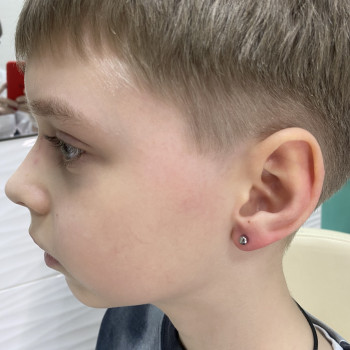 Прокол мочки вушка