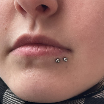 Укус павука