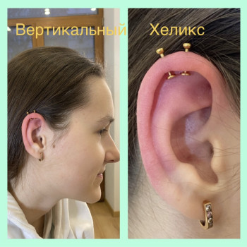 Вертикальний хелікс