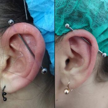 Пірсинг індастріал (з титановою прикрасою для первісного проколу)