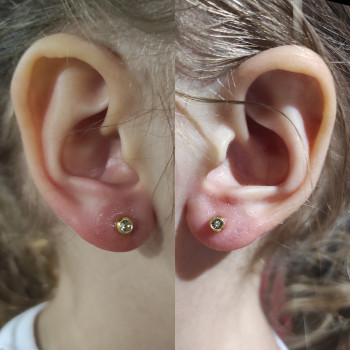 Проколювання вух пістолетом дітям