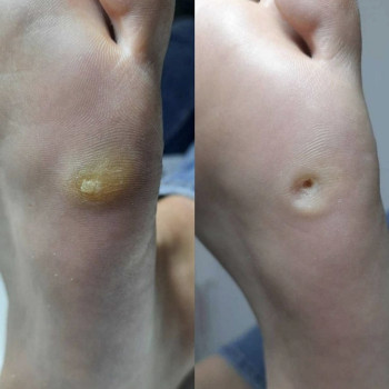 Фото с портфолио Елена Коваль