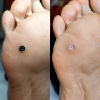 Фото с портфолио Елена Коваль