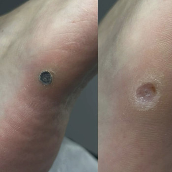 Фото с портфолио Елена Коваль