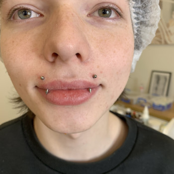 Укус Ангела