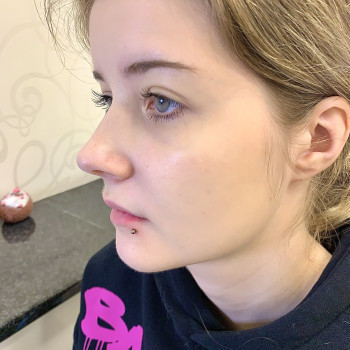 Бічний лабрет