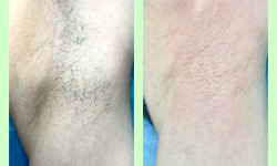 Мужская депиляция воском Мастер по пирсингу Татьяна Киев