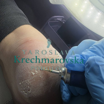 Фото с портфолио Ярослава Кречмаровська