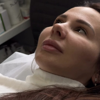 Натуральна контурна пластика губ