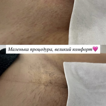 Фото с портфолио Лєна Бородуліна