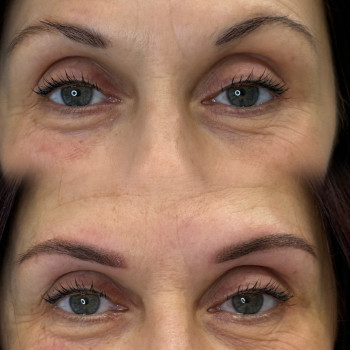 Пудрове напилення брів До та пiсля, фото - Майстер татуажу Татьяна Латова