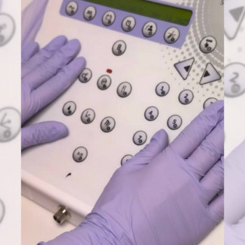 Панель сучасного апарата для електроепіляції у студії в Києві — точні налаштування параметрів, стерильні умови роботи та професійне обладнання. Святошинський район, поруч із метро.