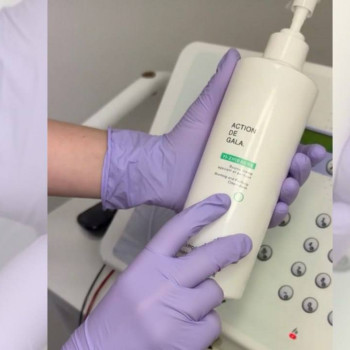 Догляд шкіри після електроепіляції у Києві — професійні засоби, стерильність.