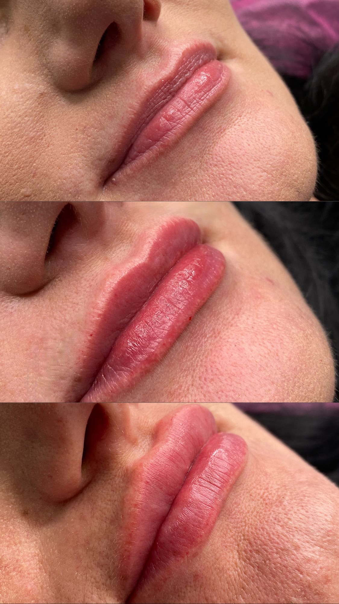 Збільшення губ, фото - Мастер татуажа Юлія Медвєдєва (Гурик)