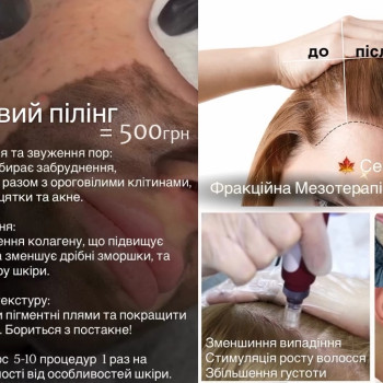 Фото с портфолио Аліса Шаргородська