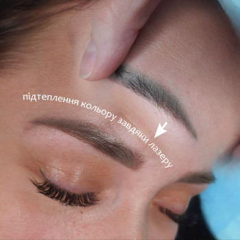 корекція перманенту лазером