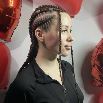 Брейди з канекалоном