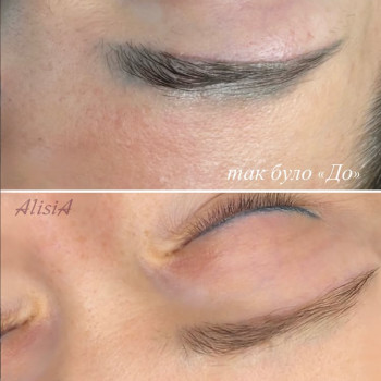 видалення перманенту