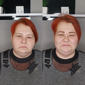 ПМ і цукровий діабет