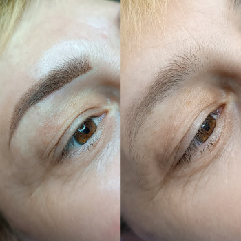 Пм брів до та після