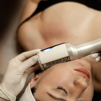 Процедура Endospheres для обличчя