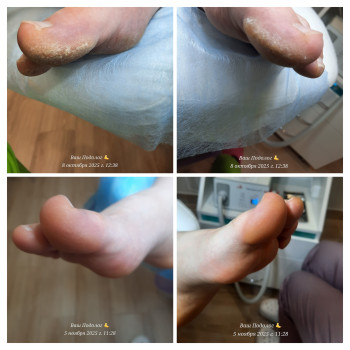 Фото с портфолио ВАШ ПОДОЛОГ Подологический центр Лауры Токаренко