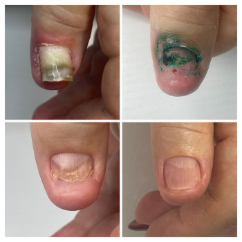 Фото с портфолио ВАШ ПОДОЛОГ Подологический центр Лауры Токаренко