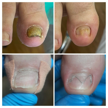 Фото с портфолио ВАШ ПОДОЛОГ Подологический центр Лауры Токаренко