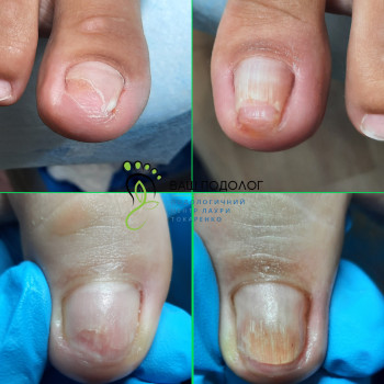 Фото с портфолио ВАШ ПОДОЛОГ Подологический центр Лауры Токаренко