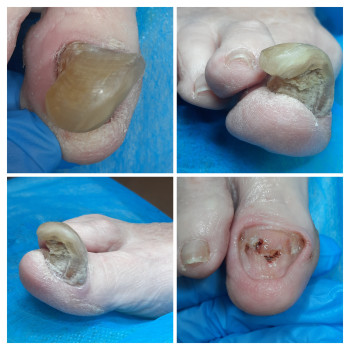 Фото с портфолио ВАШ ПОДОЛОГ Подологический центр Лауры Токаренко