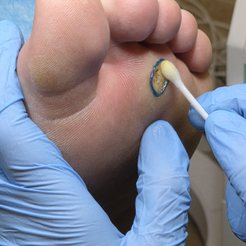 Фото с портфолио ВАШ ПОДОЛОГ Подологический центр Лауры Токаренко