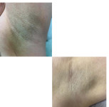 Три топ зони - 800 грн Массажист  Днепр