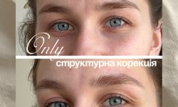  Бровист  Тернополь