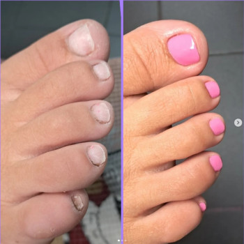 Гель-лак на ногах