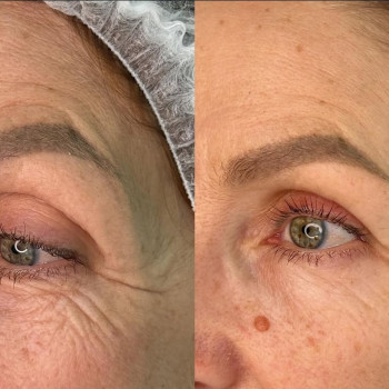 Фото с портфолио Анастасия Прийтенко