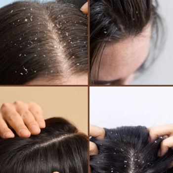 Фото с портфолио HAIRVICTORY