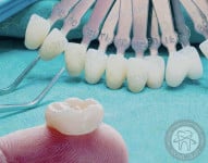 АКЦІЯ на встановлення цирконієвих коронок! Стоматологическая клиника Люми-Дент Киев