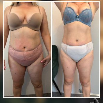 Фото с портфолио Studio18 khm