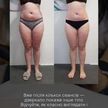 Фото с портфолио Studio18 khm