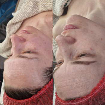 Фото с портфолио En Ajoure